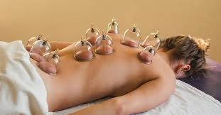 What is Hijamah Therapy?